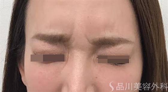 症例NO.47157のAFTER写真