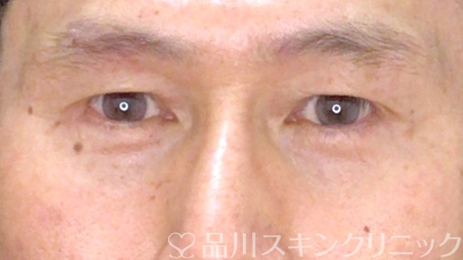 症例NO.71419のAFTER写真