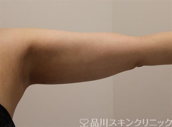 症例NO.47043のBEFORE写真