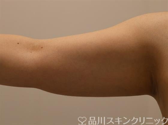 症例NO.45631のBEFORE写真