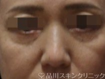 症例NO.71376のAFTER写真