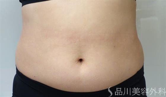 症例NO.40653のBEFORE写真