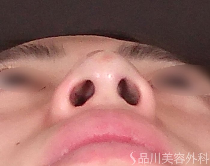 症例NO.70016のAFTER写真