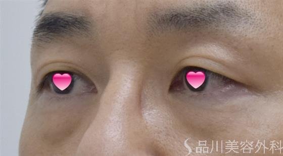 症例NO.50256のBEFORE写真