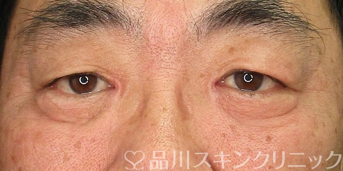 症例NO.73079のBEFORE写真