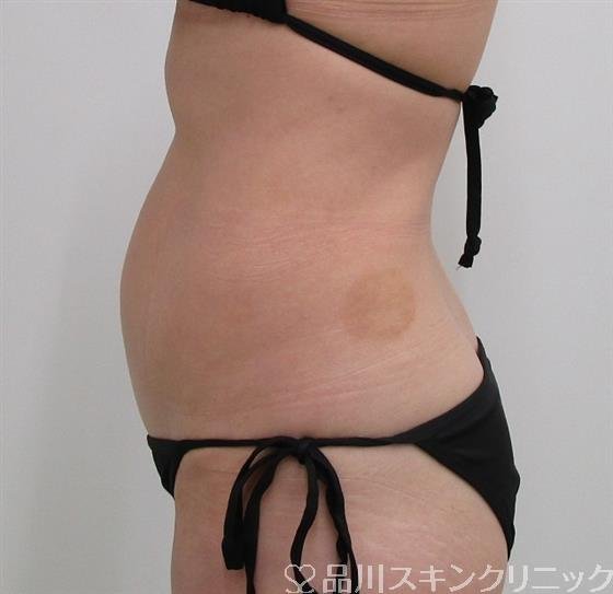 症例NO.36118のBEFORE写真