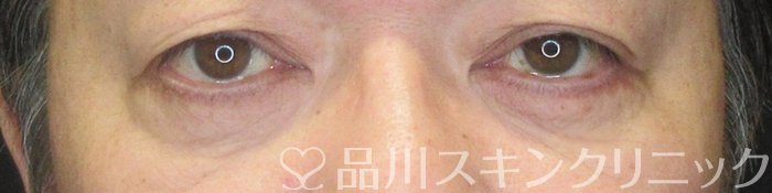 症例NO.63848のAFTER写真