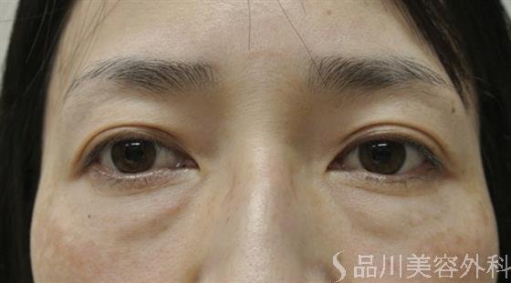 症例NO.25158のBEFORE写真