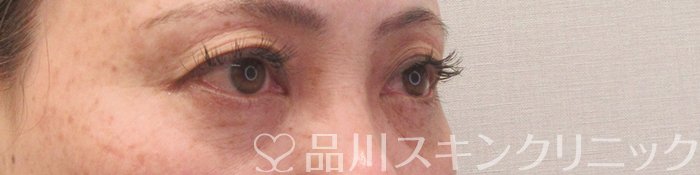 症例NO.70129のBEFORE写真