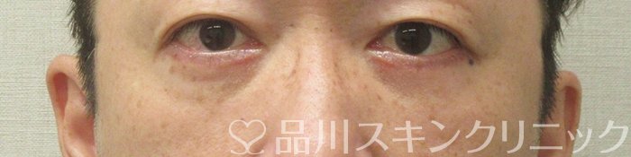 症例NO.74836のAFTER写真