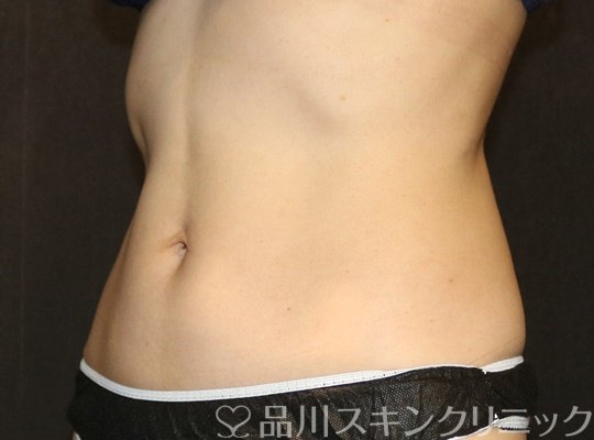 症例NO.70335のBEFORE写真