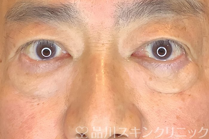 症例NO.63973のBEFORE写真