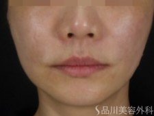 症例NO.73203のAFTER写真