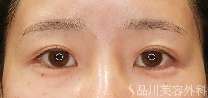 症例NO.68027のAFTER写真