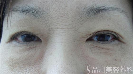 症例NO.7127のBEFORE写真