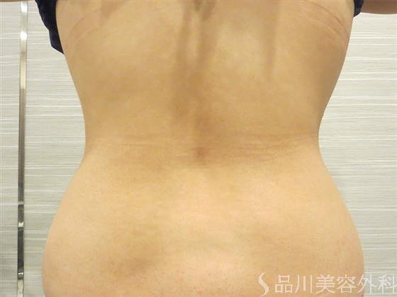 症例NO.24039のBEFORE写真
