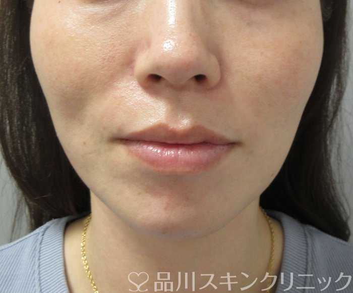 症例NO.73182のAFTER写真