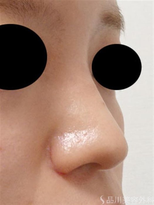 症例NO.54273のAFTER写真
