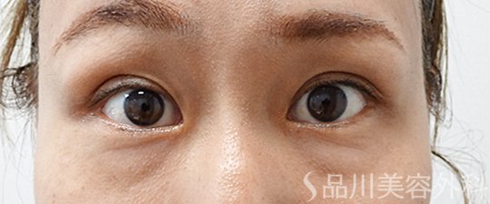 症例NO.69806のAFTER写真