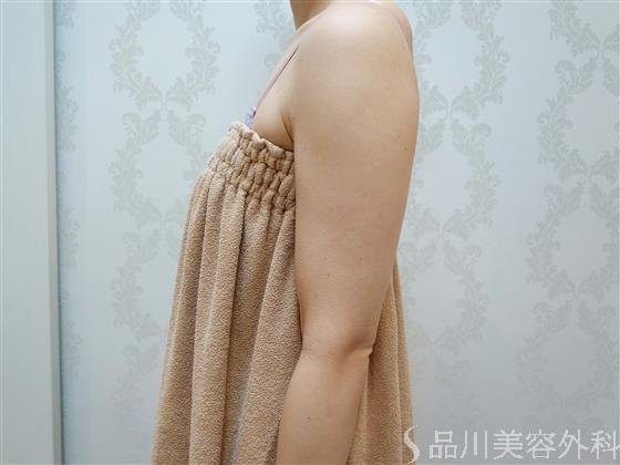 症例NO.51538のBEFORE写真