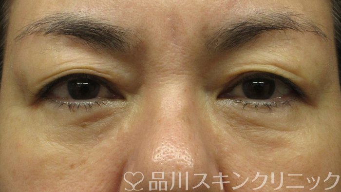 症例NO.69766のAFTER写真