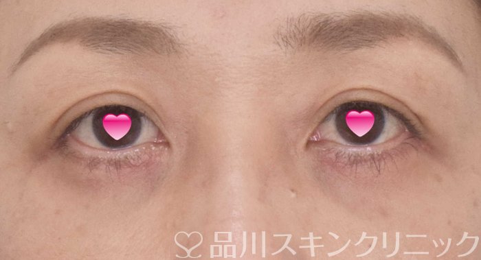 症例NO.66602のAFTER写真