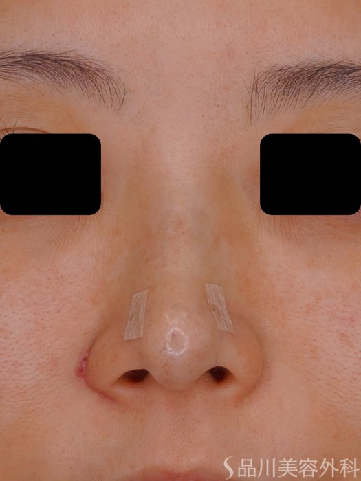 症例NO.73608のAFTER写真