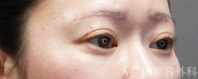 症例NO.73107のAFTER写真