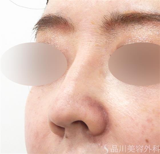 症例NO.53639のBEFORE写真