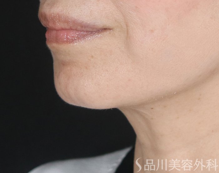 症例NO.73580のBEFORE写真