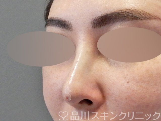 症例NO.67609のAFTER写真