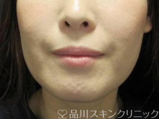 症例NO.73501のBEFORE写真