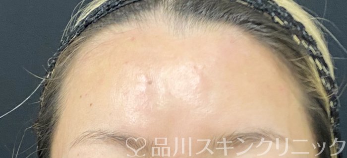 症例NO.73771のAFTER写真