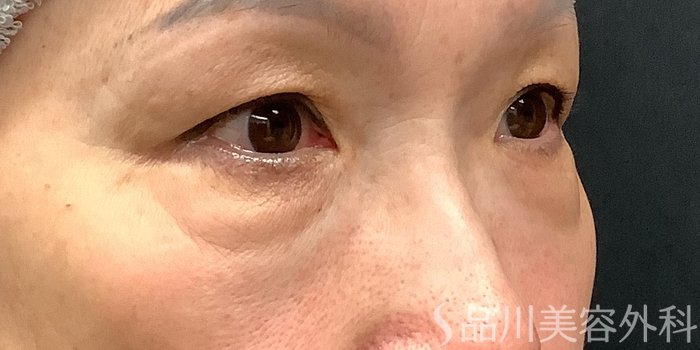 症例NO.71228のBEFORE写真
