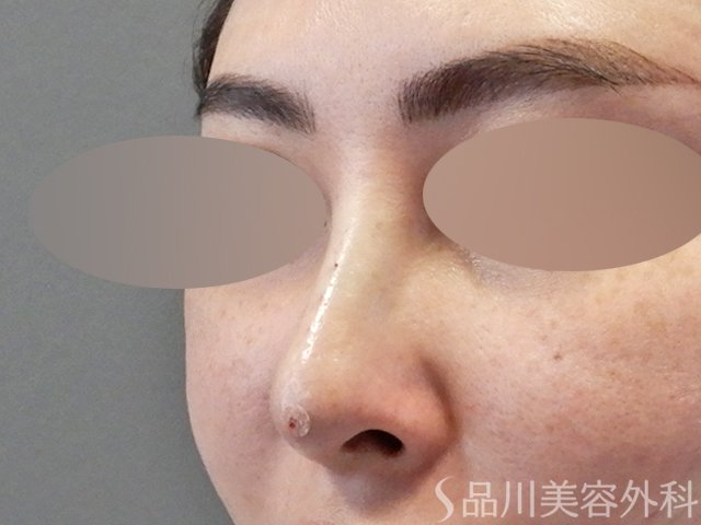 症例NO.67609のAFTER写真