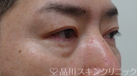 症例NO.70784のBEFORE写真