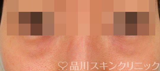 症例NO.73827のBEFORE写真