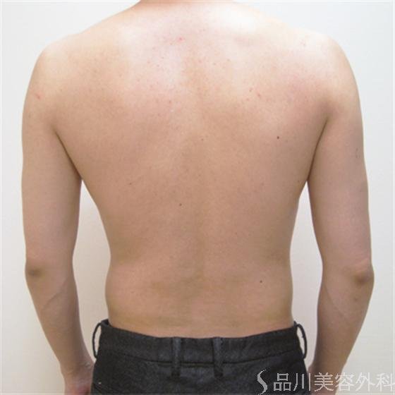 症例NO.18754のBEFORE写真