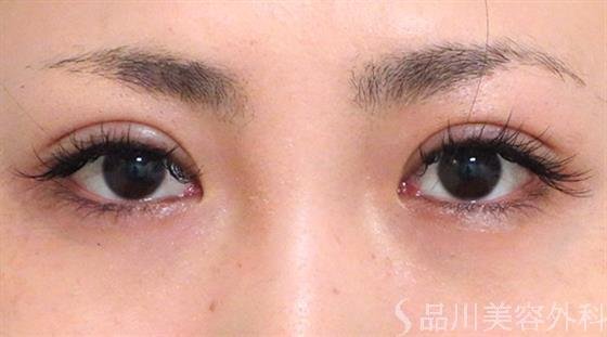 症例NO.27048のAFTER写真