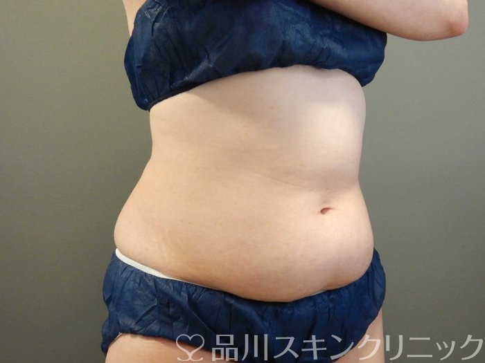 症例NO.65954のBEFORE写真