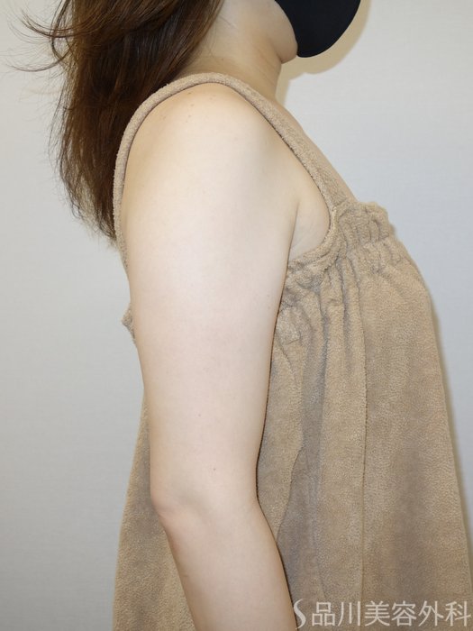 症例NO.73224のBEFORE写真