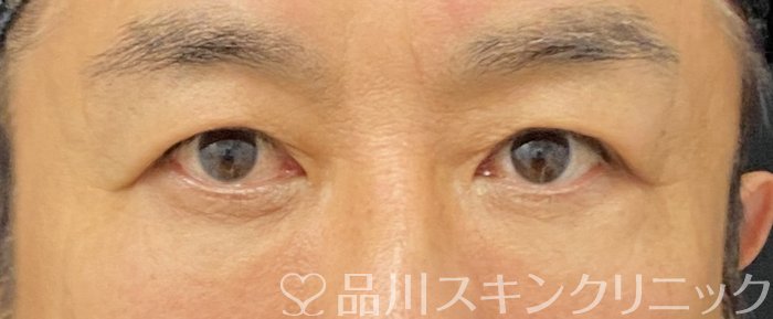 症例NO.74818のAFTER写真