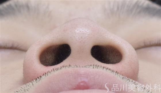 症例NO.54163のBEFORE写真