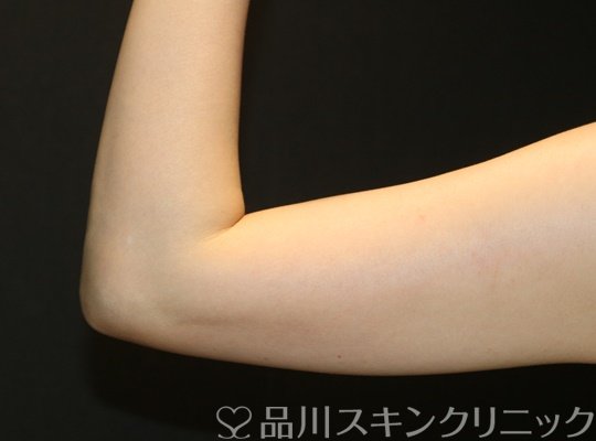 症例NO.72367のBEFORE写真