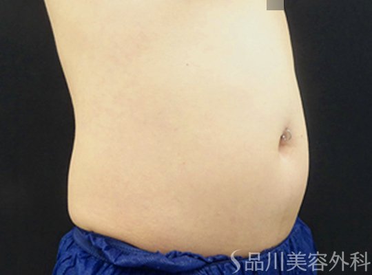 症例NO.70205のBEFORE写真