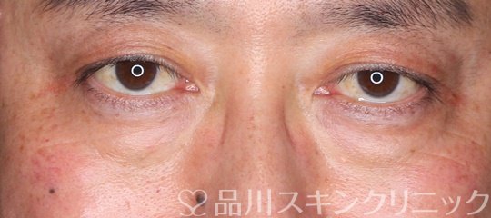 症例NO.70877のBEFORE写真