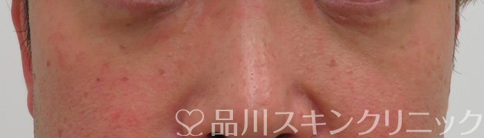 症例NO.65292のAFTER写真