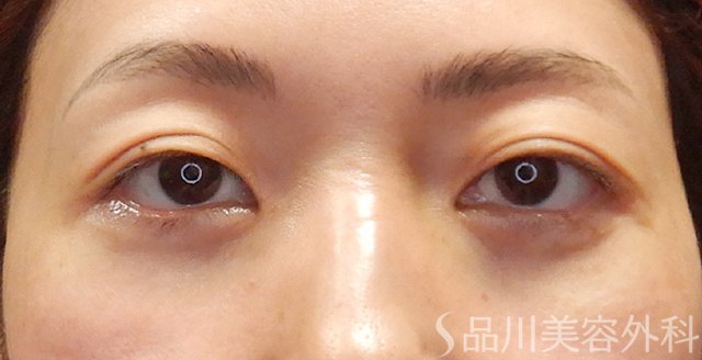 症例NO.73999のAFTER写真