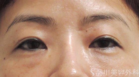 症例NO.25741のBEFORE写真