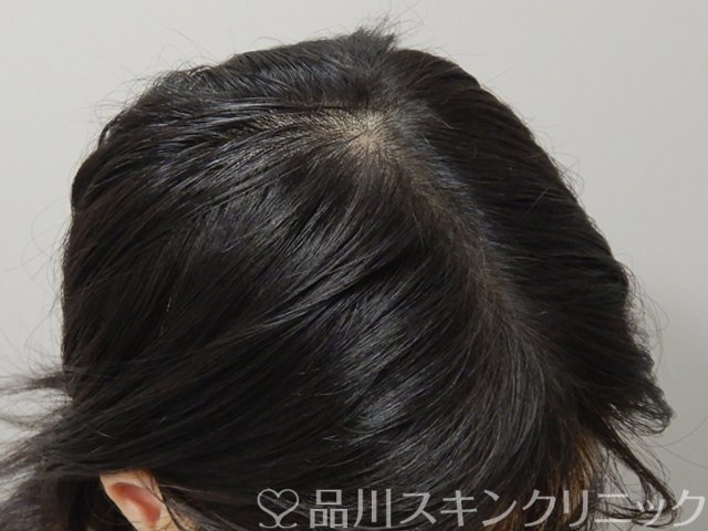 症例NO.69113のAFTER写真